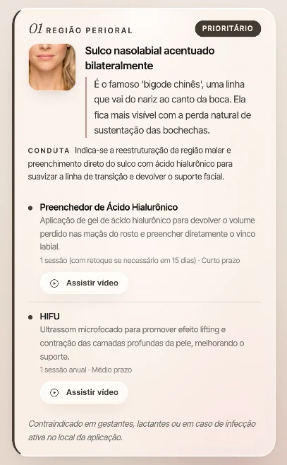 Laudo do Allbele: achado de sulco nasolabial acentuado com conduta indicada e os procedimentos preenchedor de ácido hialurônico e HIFU do catálogo da clínica